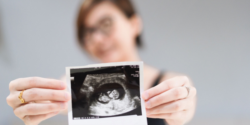Monitoring Your Baby's Development: Exploring the 12-Week Scan